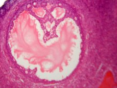 �����ѵĲ���' /></a></div>
		<div class=